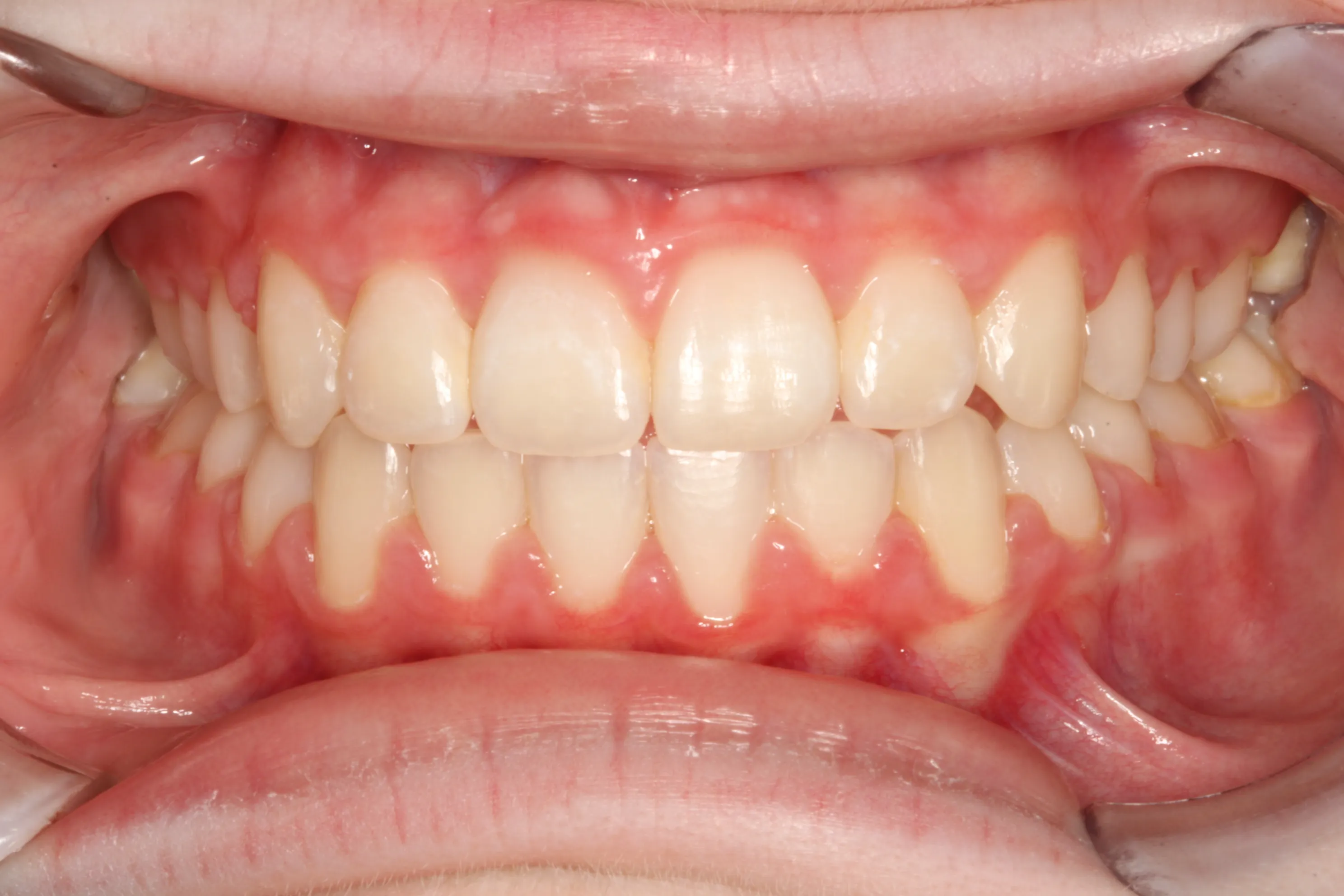 smile-gallery gallery